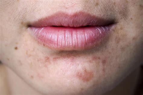 Turmeric's Benefits For Your Skin and Hair | The Healthy