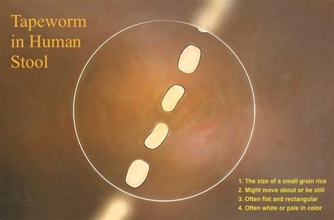 What Do Tapeworm Segments Look Like In Human Stool - Infoupdate.org