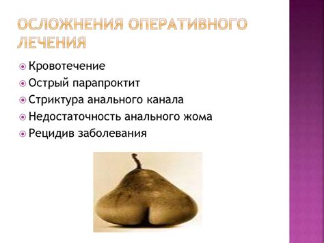 Геморрой. Предрасполагающие факторы - online presentation