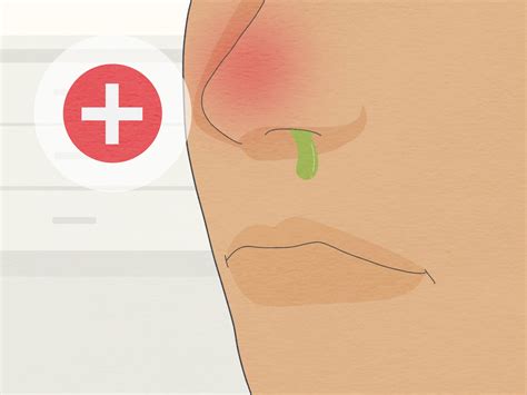 How to Sleep with a Stuffy Nose: 18 Tips and Home Remedies