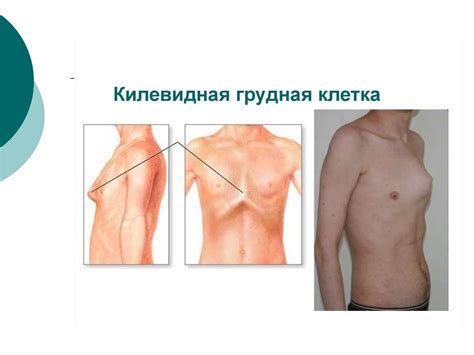 Анатомия грудной клетки - презентация онлайн