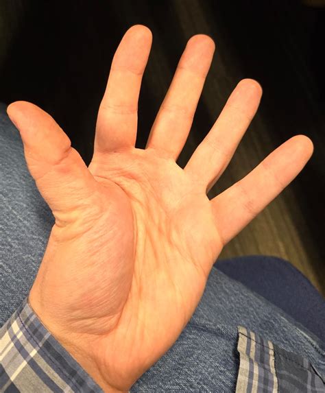 My left thumb can twist in a weird way. Idk how common this is but