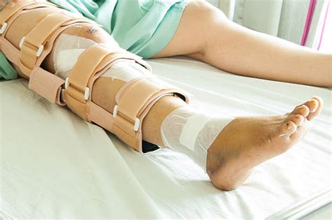 Leg Brace Pictures, Images and Stock Photos - iStock