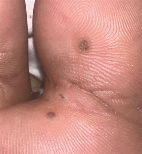 What is this under my foot please! : r/medical_advice