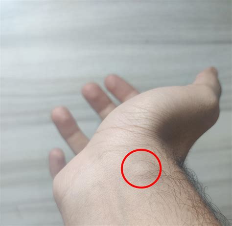 I had this small bump on my wrist for a long time now, can anyone tell