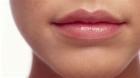 Staph Infection On Lips