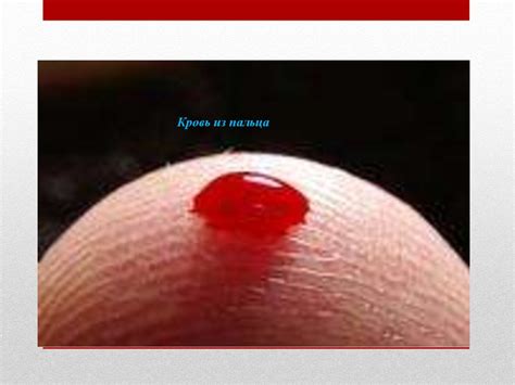 Первая помощь. Виды кровотечения - online presentation