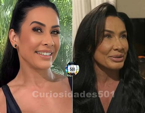 Sheila Carvalho Antes E Depois Da Harmonização Facial - Curiosidades - Scheila Carvalho antes e depois da HARMONIZAÇÃO FACIAL ...