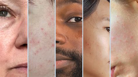 guide  identifying  skin type noie noie