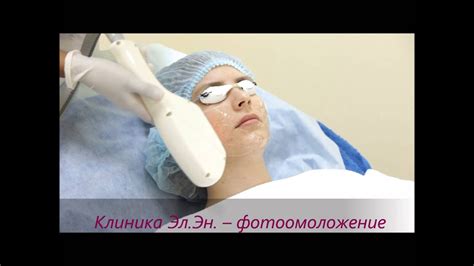 Фотоомоложение лица - YouTube