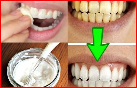 O Usar Para Clarear Os Dentes - 10 maneiras de usar o bicarbonato de sódio para clarear os dentes ...