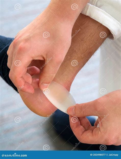 Painful Heel Wound on Mans Feet Caused by New Shoes. Mans Hands Stock