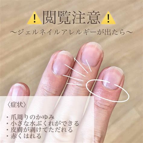 SHジェルネイル（ライト対応）｜セリアの辛口レビュー「【ジェルネイルアレルギー⚠️要注意⚠️HE..」 by リサ｜ラジオパーソナリティ(敏感 ...