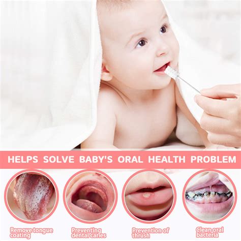 Treats for newborn with oral thrush reveal a secret home cure 8