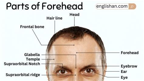 strands   forehead called