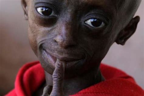 African girl takes solace in being unique as a black child with ...