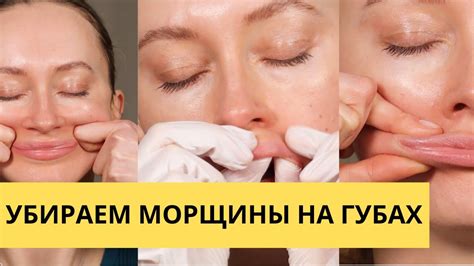 Убираем морщины над верхней губой (кисетные морщины) - YouTube