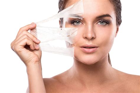 Everything You Should Know About a VI Peel Treatment | A Better Solution