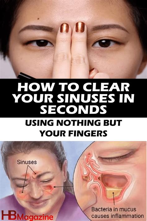 How to clear sinuses – Artofit