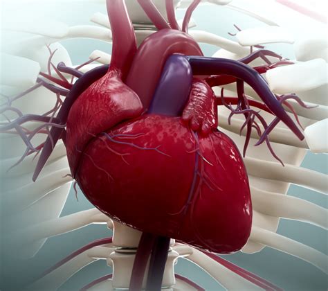 Aortic dissection - NYSORA