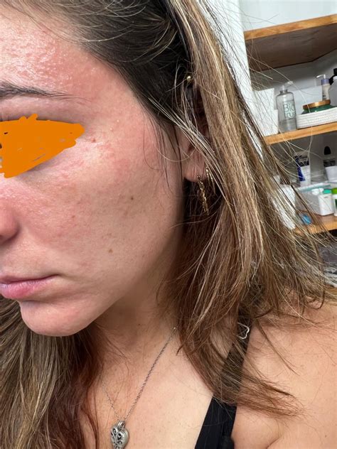 The charlie dixon fox breakout performance that shocked the whole league 26