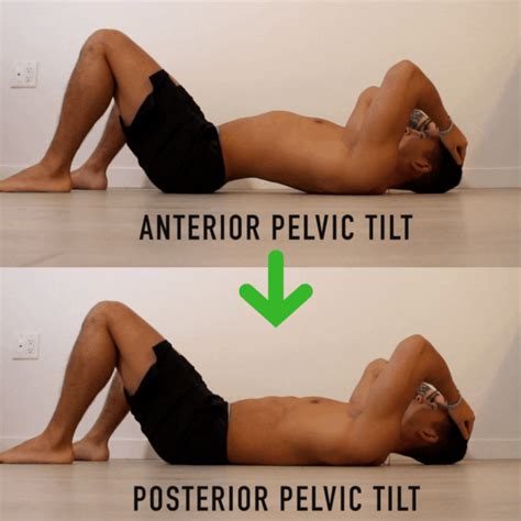 fix anterior pelvic tilt   minutes  day   corrective routine