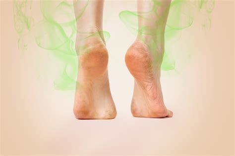 Tips to Prevent Foot Odor | Care for Yoo