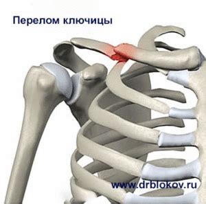 Перелом плечевой кости | Симптомы | Лечение травмы