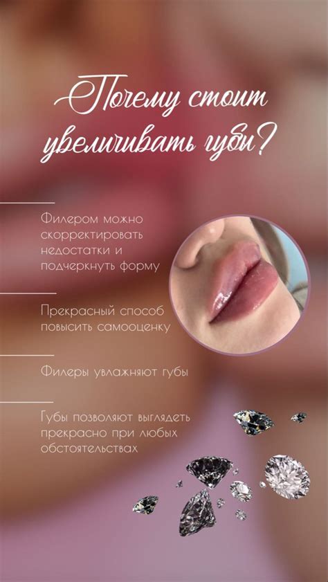 Увеличение губ | Губы, Инъекции губ, Увеличение губ