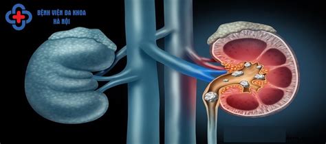 dau soi  ben trai dau hieu nguyen nhan va phuong phap dieu tri