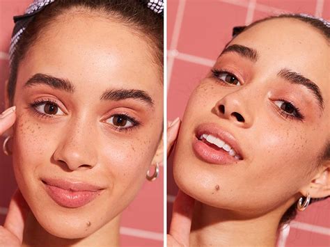 The Difference Between Freckles and Sun Spots | Skincare.com