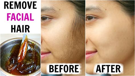How To Remove Facial Hair (Demonstration) KATORI WAX - In 10 Minutes ...