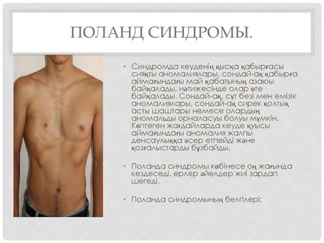 Кеуде қуысының деформациясы - презентация онлайн