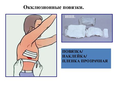 Пневмоторакс. Виды пневмоторакса - презентация онлайн