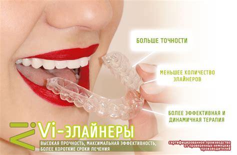 Ровные зубы без брекетов