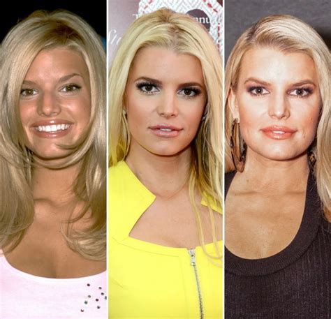 Jessica Simpson Plastic Surgery