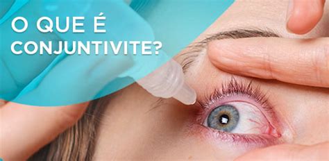 Conjuntivite O Que Usar - O que é conjuntivite nos olhos? Descubra de uma vez por todas! 👀