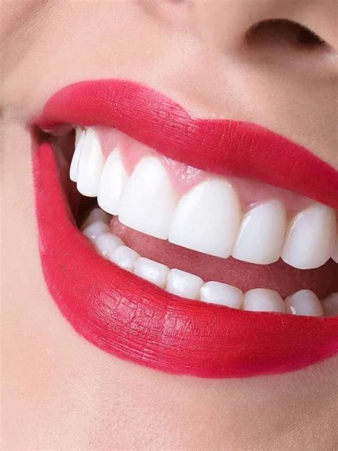 10 Resolutions for a New Year, New Smile Transformation - World of ...