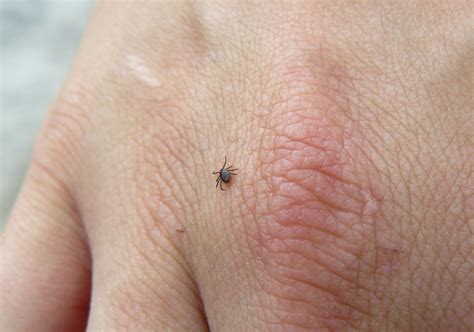 Ash Out of Doors: Blacklegged Ticks in Ottawa!