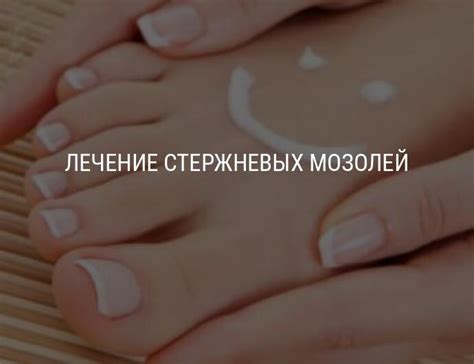 Лечение стержневых мозолей, удаление сухой мозоли со стержнем