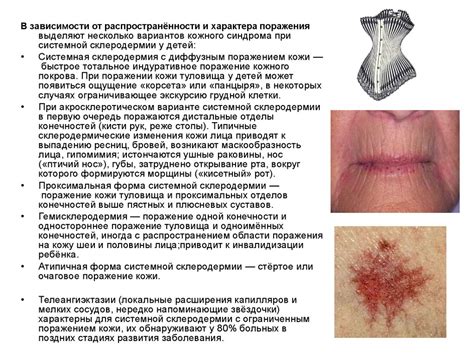 Ювенильная системная склеродермия - презентация онлайн