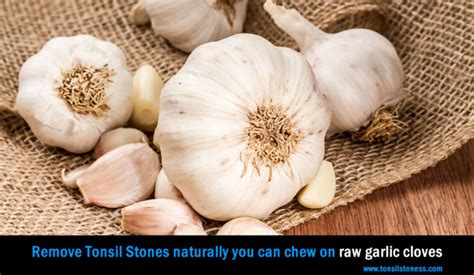how to clear tonsil stones at home