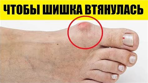 YouTube | Лечение ног, Товары для здоровья, Журнал о здоровье