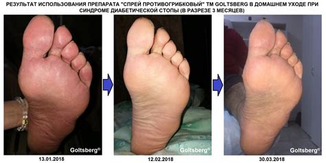 Что такое ступня у человека фото