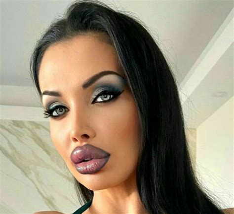 by Jonna on Lips filler | Blonde hair girl, Botox lips, Girls lips