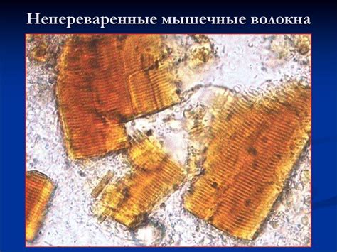 Копрологическое исследование. Исследование кала - презентация онлайн