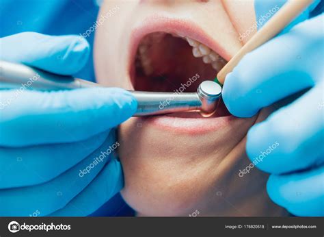 Treatment Tooth Loss Modern Dental Technologies — Stock Photo © Romaset ...