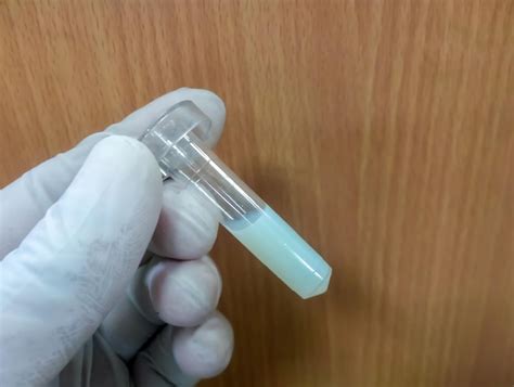 lipemic images    freepik