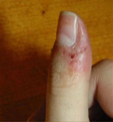 While Chewing The Skin Around Your Fingers You Probably Never Thought