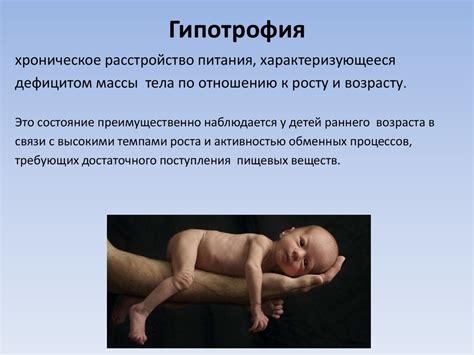 Питание больного ребенка - презентация онлайн